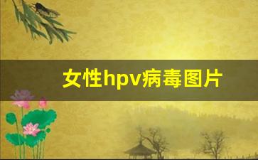 女性hpv病毒图片