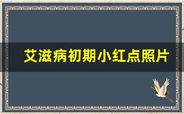 艾滋病初期小红点照片_高危性行为后多久出现症状